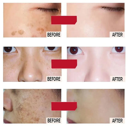 Crème éclaircissante AILKE